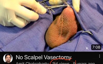 My No Scalpel Vasectomy Video Have Crossed  One Million Views